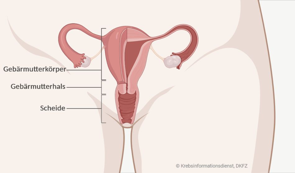 Grafische Darstellung von Gebärmutterkörper, Gebärmutterhals und Scheide.