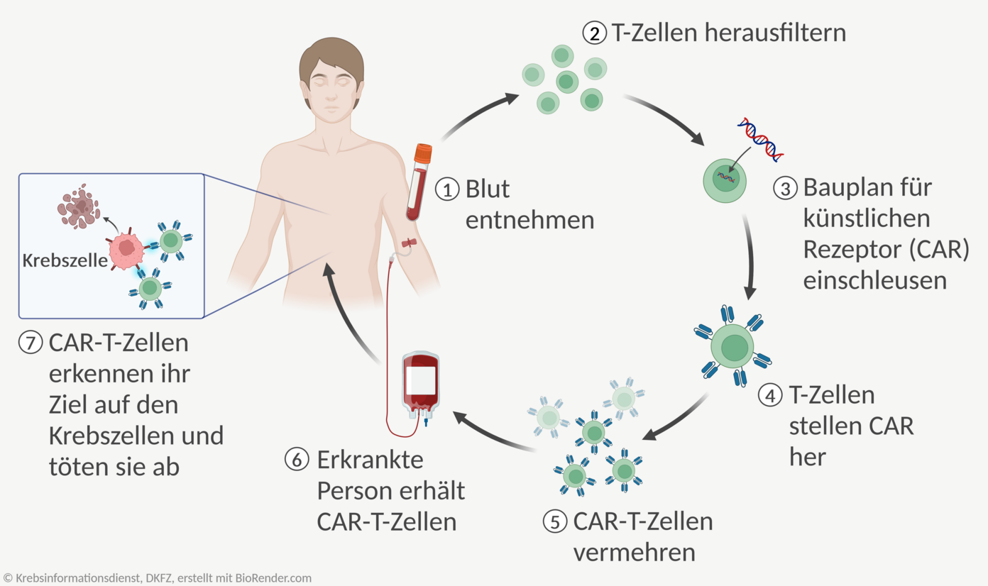 Behandlung Der Akuten Lymphatischen Leuk Mie All Dkfz