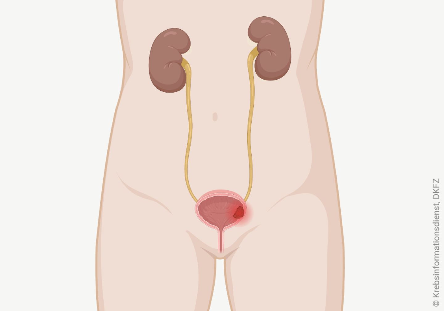 Schematische Darstellung der ableitenden Harnwege mit Nieren, Harnleiter, Harnblase und Harnröhre