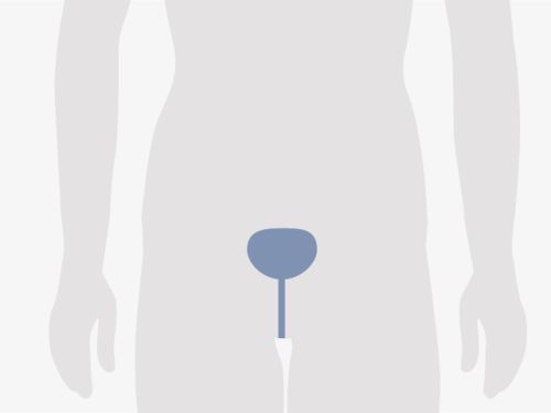 Grafische Darstellung eines menschlichen Oberkörpers, blau eingefärbt ist die Blase.