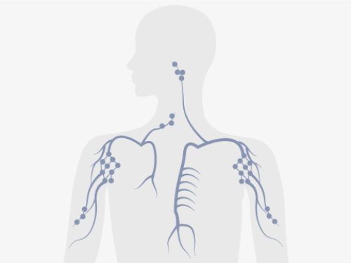 Lymphbahnen und Lymphknoten sind im ganzen Körper verteilt.