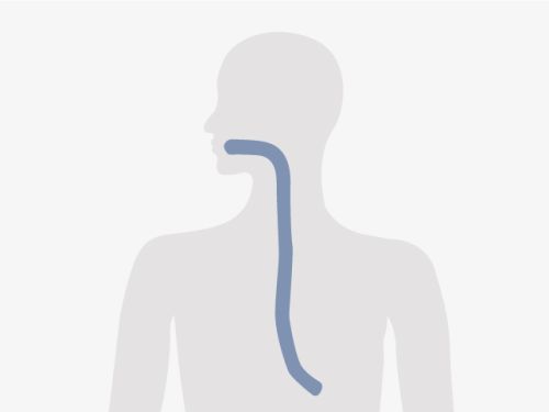 Grafische Darstellung eines menschlichen Oberkörpers, blau eingefärbt ist die Speiseröhre.