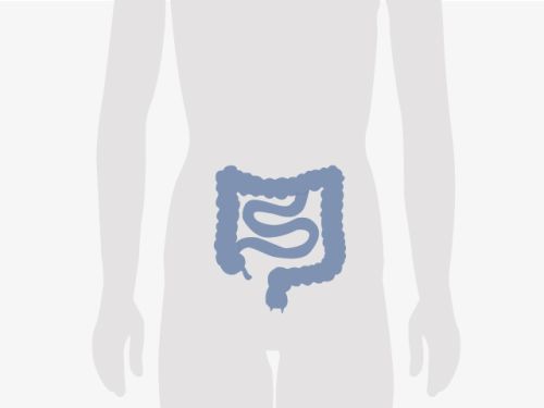 Grafische Darstellung eines menschlichen Unterkörpers, blau eingefärbt ist der Darm.