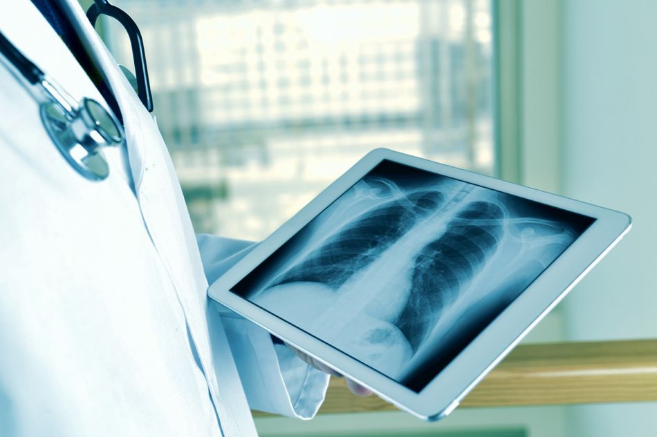 Ein Arzt betrachtet ein Röntgenbild der Lunge auf einem Tablet (mobiles Endegerät).© nito, Adobe Stock