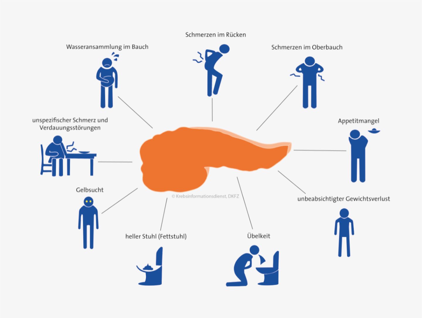 Mindmap verschiedener Beschwerden, die auf Bauchspeichelkrebs hinweisen können. Grafik: Asena Tunali © Krebsinformationsdienst, DKFZ