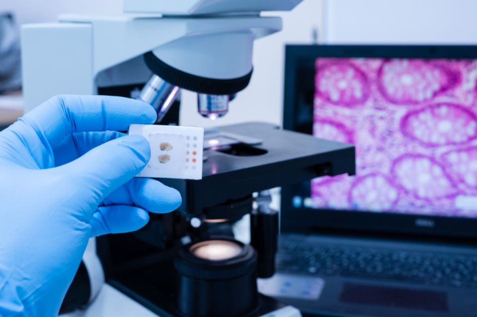 Eine Hand mit blauem Handschuh hält eine in Paraffin eingebettete Gewebeprobe vor ein Mikroskop. Im Hintergrund zeigt ein Bildschirm ein histologisches Bild.