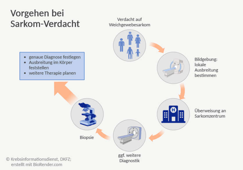 Vorgehen als Prozess dargestellt: Bei Verdacht auf ein Weichgewebesarkom folgt zunächst die Bildgebung, um die lokale Ausbreitung zu bestimmen. Die weitere Diagnostik soll dann an einem Sarkomzentrum erfolgen, ebenso eine Biopsie. Nach diesen Schritten können Fachleute die genaue Diagnose festlegen, die Ausbreitung im Körper feststellen sowie die Therapie planen.