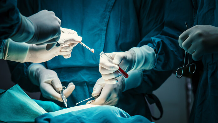 Medizinisches Fachpersonal in Schutzkleidung entnimmt während einer Operation eine Gewebeprobe und gibt sie mithilfe einer Pinzette in ein Reagenzglas mit roter Flüssigkeit.