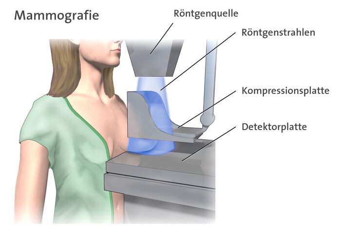 Infografik, die zeigt, wie eine Frau am Mammographie-Gerät steht und ihre Brust geröngt wird. Der Aufbau des Geräts ist mit Röntgenquelle, Röntgenstrahlen, Kompressionsplatte und Detektorplatte beschriftet.