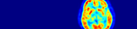 Aufnahme eines Positronen-Emissionstomographen (PET).
