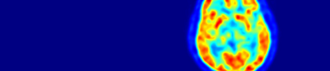 Aufnahme eines Positronen-Emissionstomographen (PET).