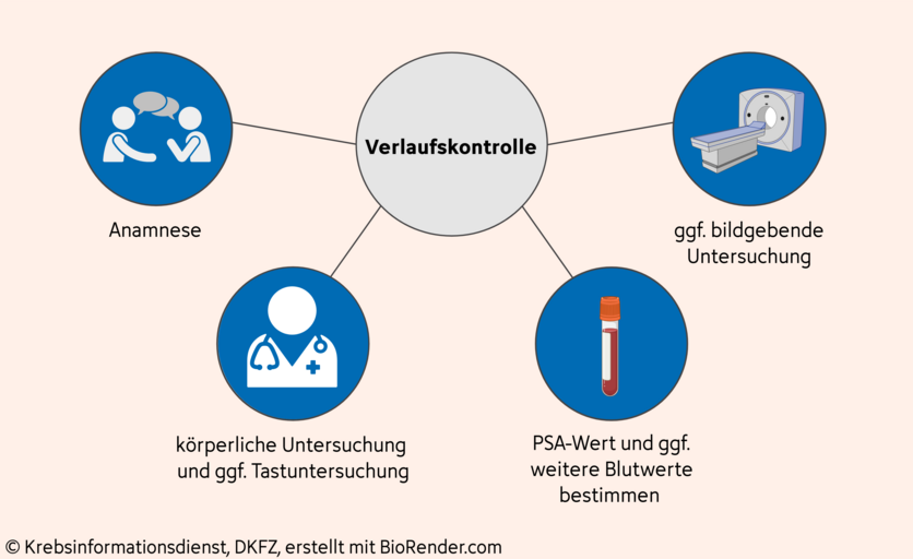 Verlaufskontrolle unter einer Hormontherapie bei Prostatakrebs, © Krebsinformationsdienst, DKFZ; erstellt mit BioRender.com Mindmap mit den Untersuchungen bei einer Verlaufskontrolle unter einer Hormontherapie bei Prostatakrebs. Dazu gehören: eine Anamnese, eine körperliche Untersuchung, die Bestimmung des PSA-Wertes im Blut und gegebenenfalls weitere Blutwerte sowie unter Umständen eine Tastuntersuchung und bildgebende Verfahren.