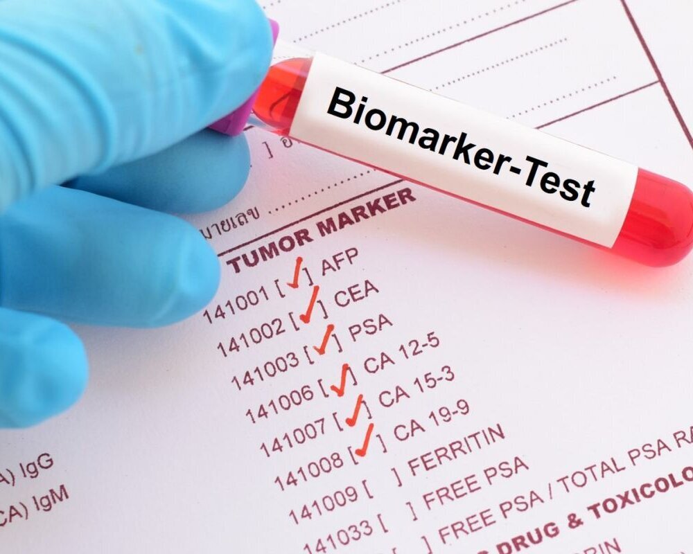 Molekulare Diagnostik: Personalisierte Krebsmedizin | DKFZ ...