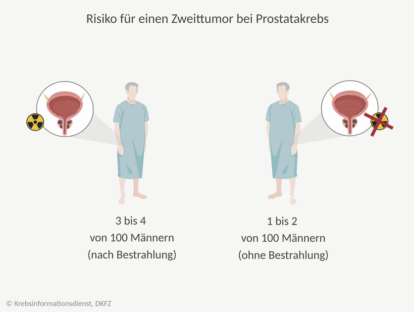 Grafische Darstellung: Unter 100 bestrahlten Patienten sind etwa 1 bis 2 Männer mehr von einem Zweittumor betroffen, als Männer, die keine Strahlentherapie erhalten haben.