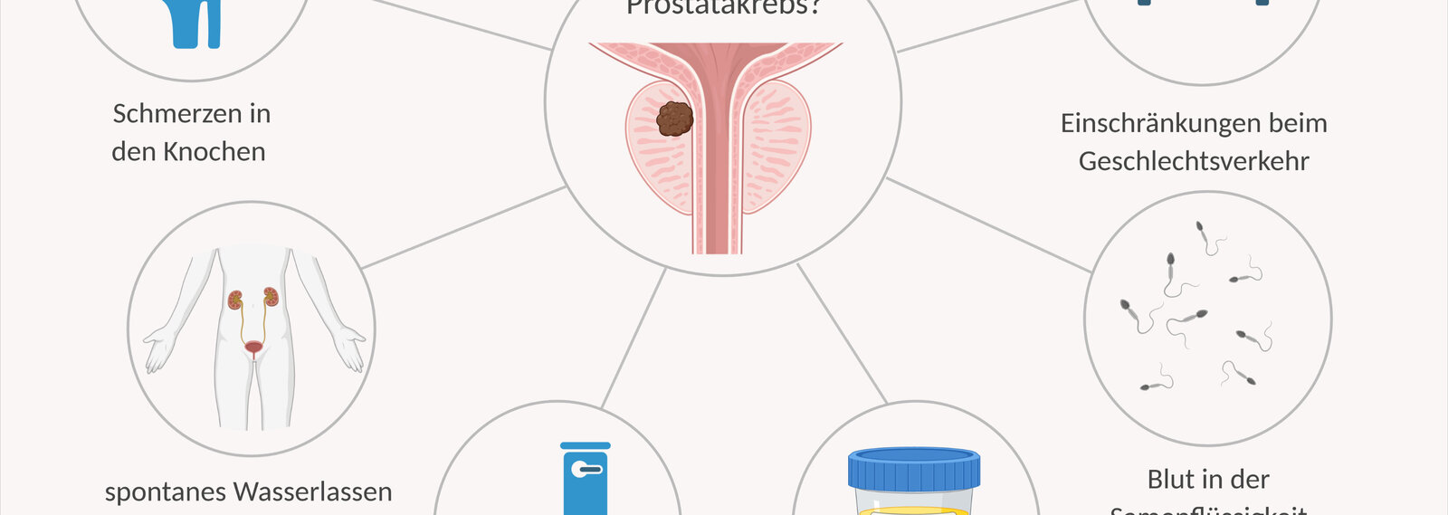Prostatakrebs Symptome und Anzeichen   DKFZ   Krebsinformationsdienst