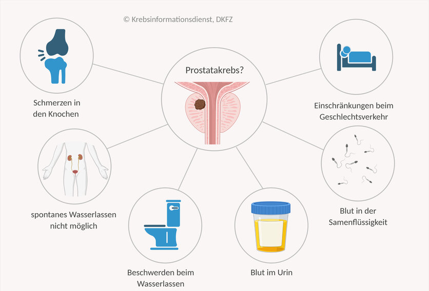 Mindmap möglicher Beschwerden bei Prostatakrebs: Knochenschmerzen, Blut in Urin oder Samenflüssigkeit, Beschwerden beim Wasserlassen, spontanes Wasserlassen nicht möglich und Einschränkungen beim Geschlechtsverkehr.