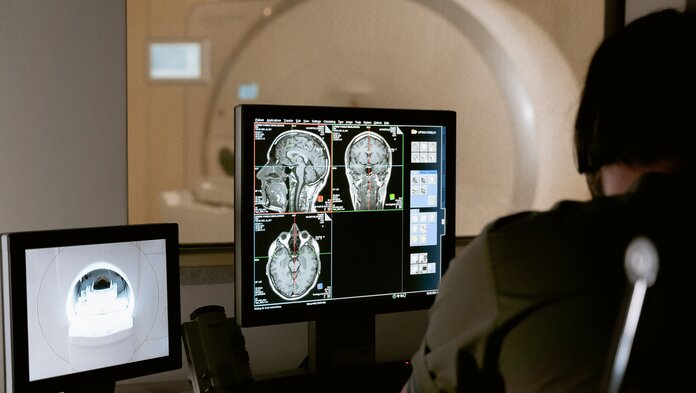 PC-Bildschirm mit MRT-Bildern des Gehirns, im Vordergrund ist eine Person zu sehen, die sich diese Bilder ansieht, im Hintergrund ein MRT-Gerät