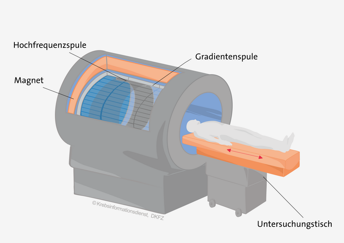 Ein Magnetresonanztomograph besteht aus einem röhrenförmigen Gerät mit einem starken Magneten und einem beweglichen Untersuchungstisch.