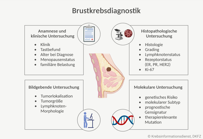Die Grafik zeigt verschiedene Bausteine der Brustkrebsdiagnostik: Anamnese und klinische Untersuchung sowie bildgebende, histopathologische und molekulare Diagnostik.