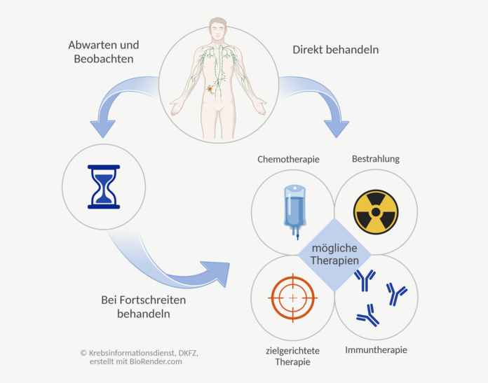 Therapieoptionen bei Lymphomen sind grafisch dargestellt: Zur direkten Behandlung eignen sich zum Beispiel Chemotherapie, Bestrahlung, zielgerichtete Therapie, Immuntherapie; bei manchen Lymphomen ist auch Abwarten und Beobachten eine Option.