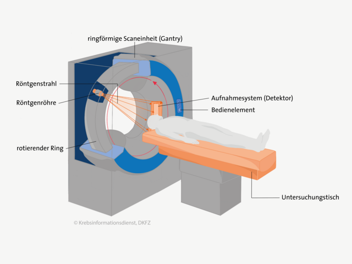 Schematische Darstellung eines Computertomographen: Ein CT-Gerät besteht aus einerringförmigen Scaneinheit und einem beweglichen Untersuchungstisch.