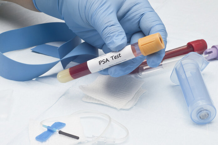 Röhrchen mit einer Blutprobe, auf einem Etikett steht "PSA-Test".