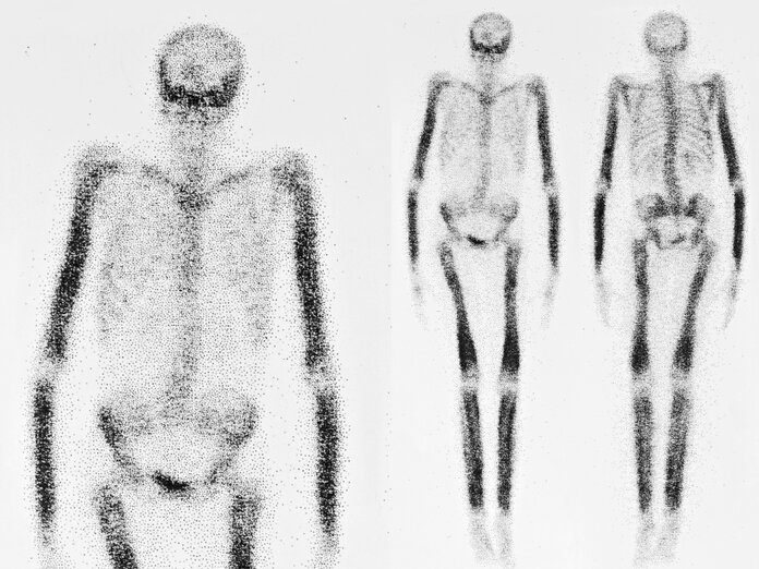 Schwarz-weiße, schemenhafte Darstellung eines Skeletts