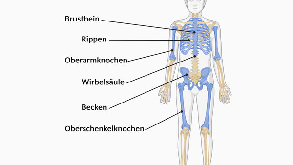 Auftreten von Knochenmetastasen, © Krebsinformationsdienst, DKFZ, erstellt mit Biorender.com Darstellung des menschlichen Skeletts. Eingefärbt sind: Brustbein, Rippen, Wirbelsäule, Becken sowie Oberarm- und Oberschenkelknochen.