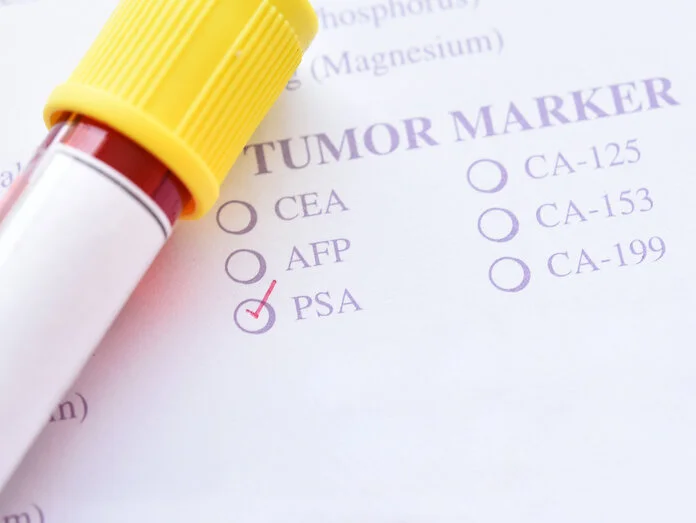 Tumormarker-Test, © jarun011, Thinkstock Blutröhrchen mit Testunterlagen