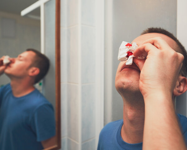 Ein Mann drückt sich ein blutiges Taschentuch auf die Nase.