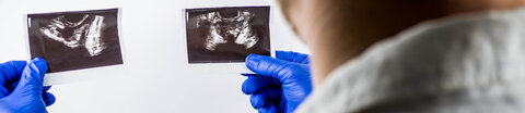 Ultraschallbilder, © Video_Stock _Production, Shutterstock Ein Arzt begutachtet Ultraschallbilder der Prostata.