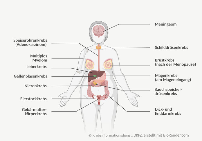 Krebsarten mit erhöhtem Risiko durch Adipositas, © Krebsinformationsdienst, DKFZ; erstellt mit BioRender.com Menschliche Silhouette mit Beschriftungen: Speiseröhrenkrebs, Multiples Myelom, Leberkrebs, Gallenblasenkrebs, Nierenkrebs, Eierstockkrebs, Gebärmutterkörperkrebs, Meningeom, Schilddrüsenkrebs, Brustkrebs (nach der Menopause), Magenkrebs (am Mageneingang), Bauchspeicheldrüsenkrebs, Dick- und Enddarmkrebs.