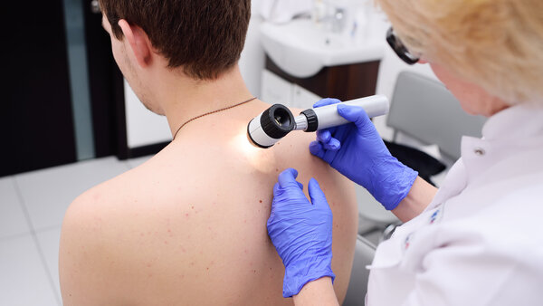 Dermatoskop, © kalinovskiy, freepik Ärztin untersucht mit einem Auflichtmikroskop die Haut auf dem Rücken eines Mannes.