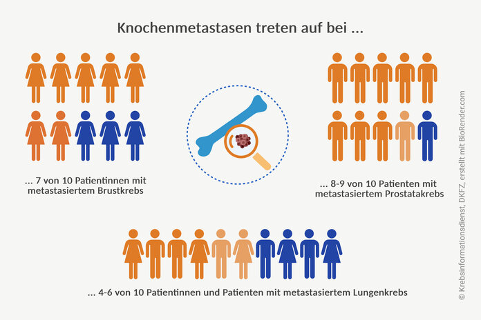 Häufigkeit von Knochenmetastasen, © Krebsinformationsdienst, DKFZ, erstellt mit BioRender.com Grafische Darstellung: Knochenmetastasen treten auf bei 7 von 10 Patientinnen mit metastasiertem Brustkrebs, 8 bis 9 von 10 Patienten mit metastasiertem Prostatakrebs und bei 4 bis 6 von 10 Erkrankten mit metastasiertem Lungenkrebs.
