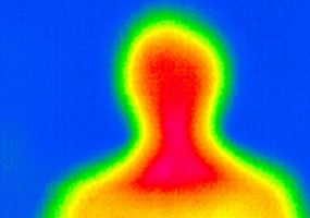 Wärmebildaufnahme von einem menschlichen Oberkörper.