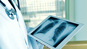 Röntgenbild einer Lunge wird auf Tablet abgebildet. © nito, Fotolia