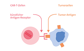 Prinzip einer CAR-T-Zell-Therapie. © Krebsinformationsdienst, Deutsches Krebsforschungszentrum